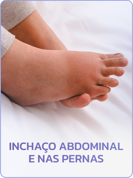 inchaço